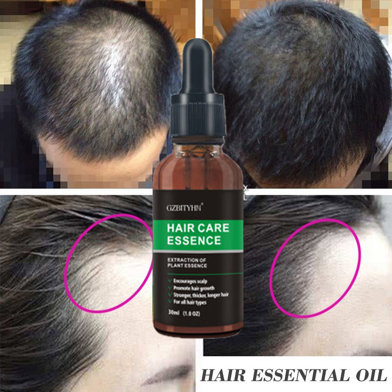 Hair Revive Natural Essence Oil - Strenghten and Growth