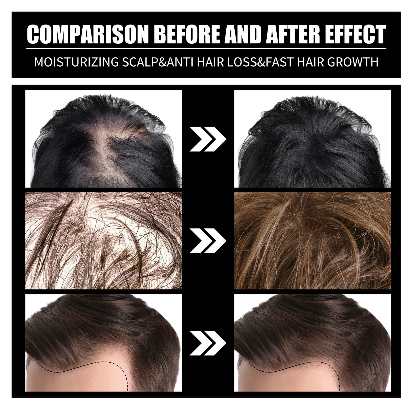 OUHOE Biotin + Collagen Hair Growth Oil – Strengthen, Densify & Prevent Hair Loss
