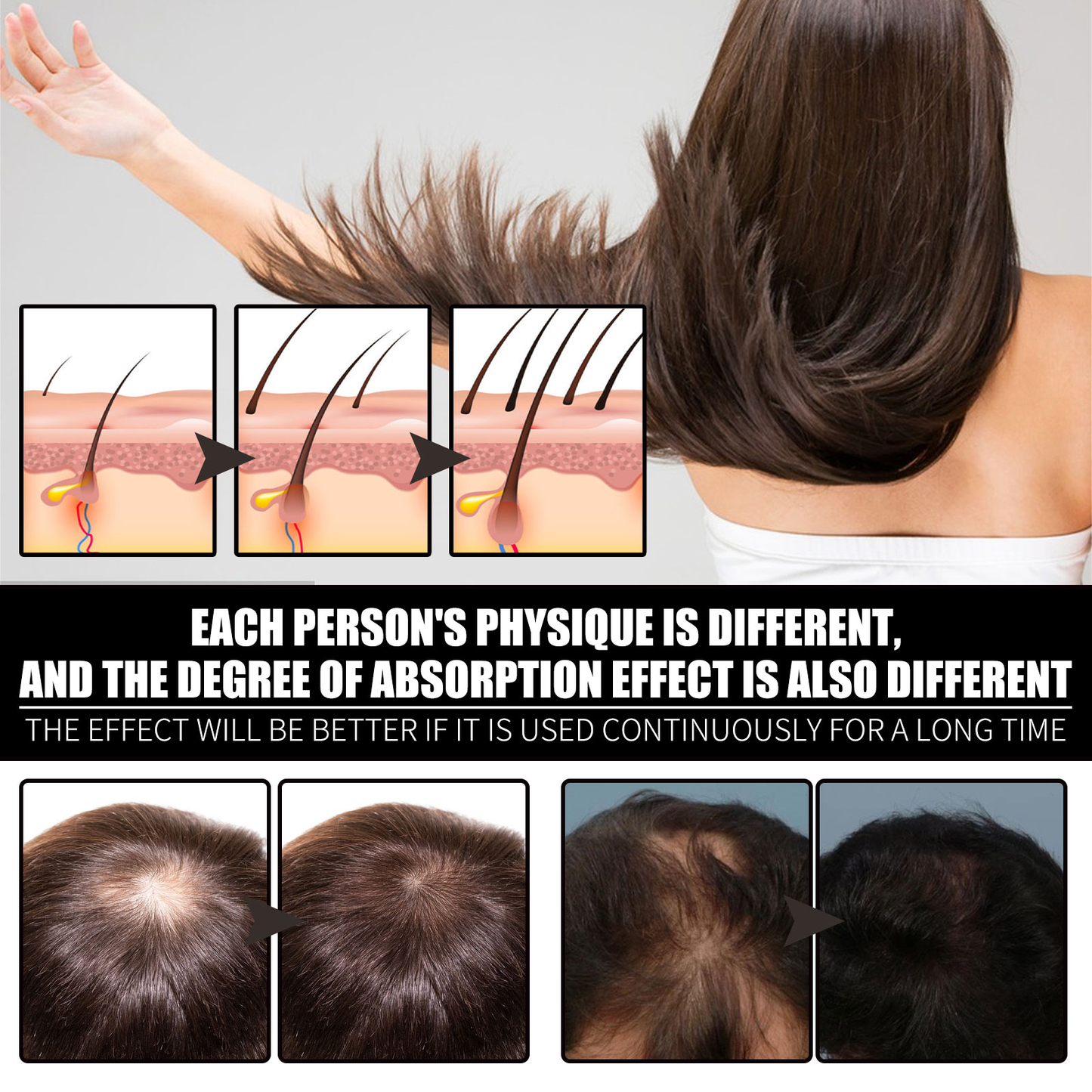 OUHOE Biotin + Collagen Hair Growth Oil – Strengthen, Densify & Prevent Hair Loss