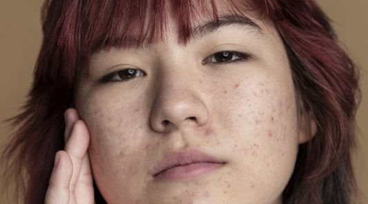 Deep Pore Cleaning: Why It Matters & 5 Products That Really Work