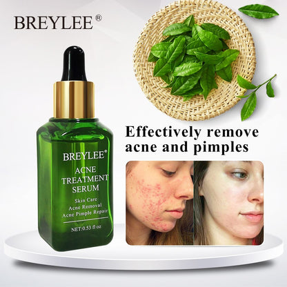 BREYLEE Natural Green Tea Tree Acne Treatment Serum