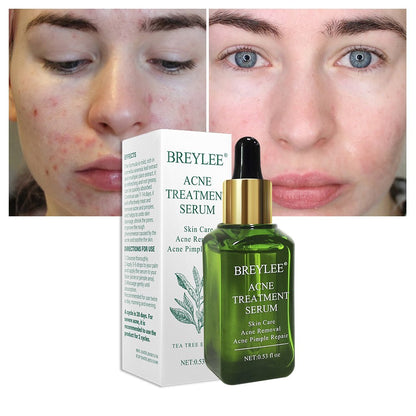 BREYLEE Natural Green Tea Tree Acne Treatment Serum