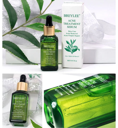 BREYLEE Natural Green Tea Tree Acne Treatment Serum